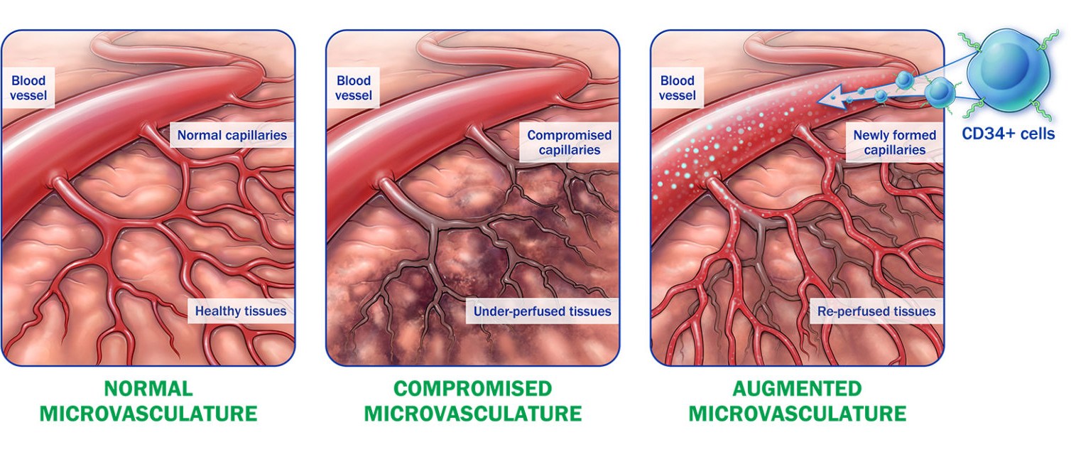 normal, compromised, and augmented microvasculature