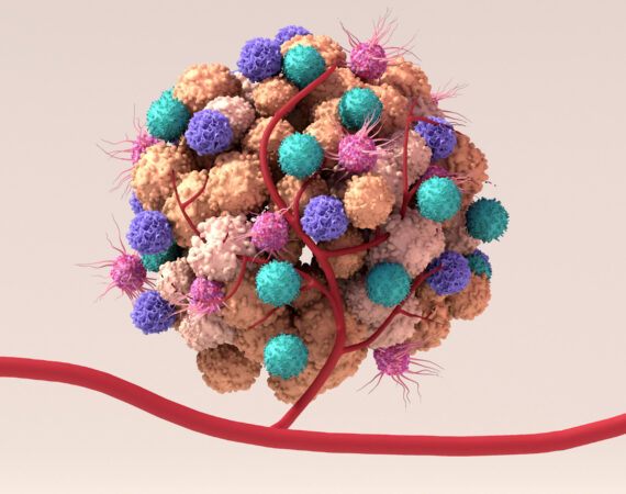 Tumor microenvironment